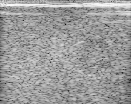 Preview for ARFI_dataset.uff