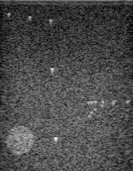 Preview for Alpinion_L3-8_CPWC_hyperechoic_scatterers.uff