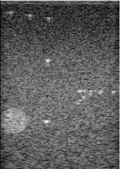 Preview for Alpinion_L3-8_FI_hyperechoic_scatterers.uff