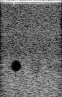 Preview for Alpinion_L3-8_FI_hypoechoic.uff