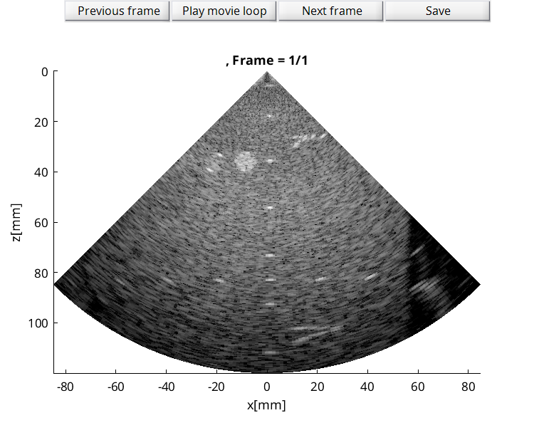 Preview for FI_P4_point_scatterers.uff