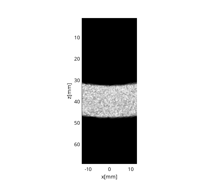 Preview for FieldII_speckle_DMASsimulation300000pts.uff