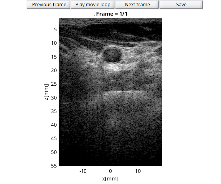 Preview for L7_FI_carotid_cross_1.uff