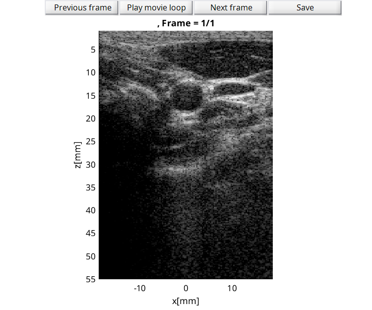 Preview for L7_FI_carotid_cross_2.uff