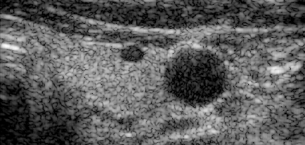 Preview for L7_FI_carotid_cross_sub_2.uff