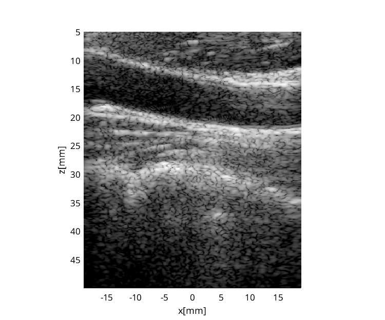 Preview for PICMUS_carotid_long.uff
