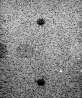 Preview for PICMUS_experiment_contrast_speckle.uff