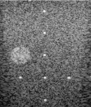 Preview for PICMUS_experiment_resolution_distortion.uff