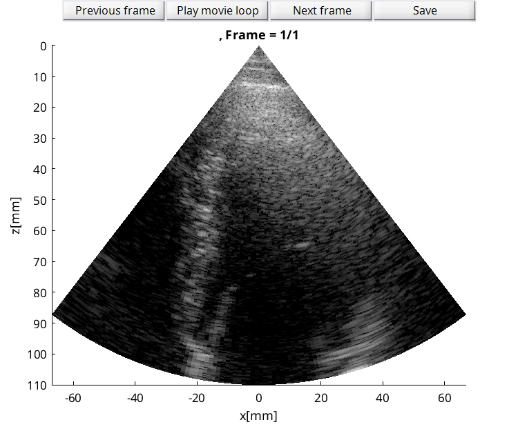 Preview for Verasonics_P2-4_apical_four_chamber_subject_1.uff