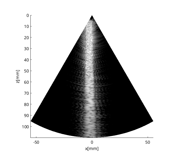 Preview for speckle_sim_FI_P4_probe_apod_2_speckle_long_many_angles.uff