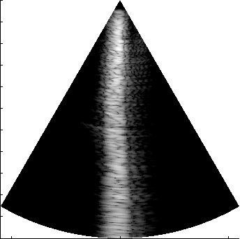 Preview for speckle_sim_FI_P4_probe_apod_3_speckle_long_many_angles.uff
