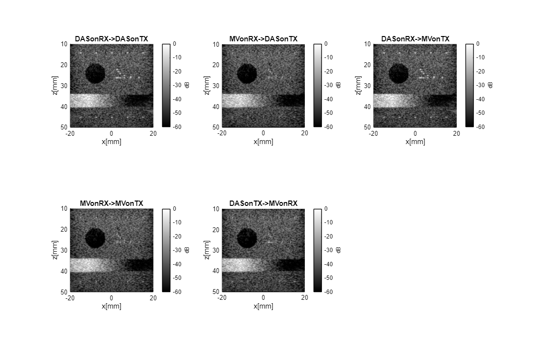 Five beamformer combinations: DAS/MV on receive and transmit, including double-adaptive MV-on-MV