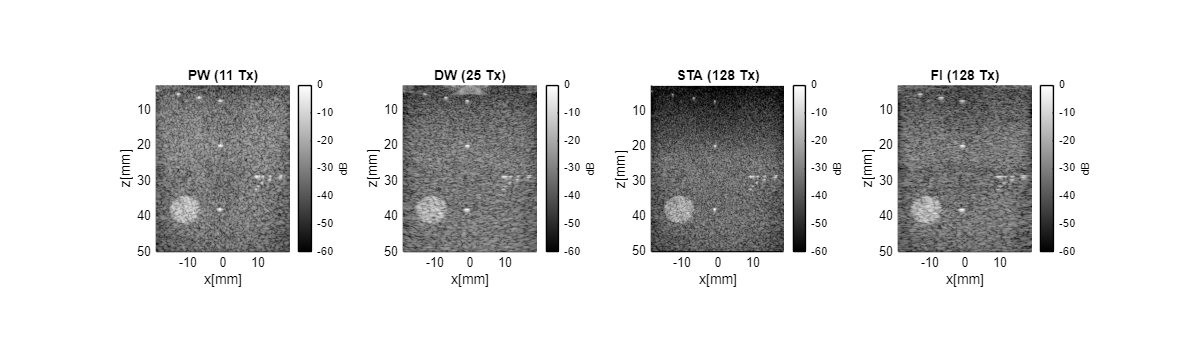 Compounded images from plane wave, diverging wave, single-element (STA), and focused transmit sequences, all beamformed with midprocess.das